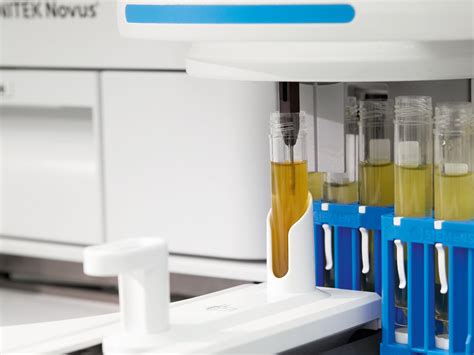 Urinalysis Urine Analyzers 